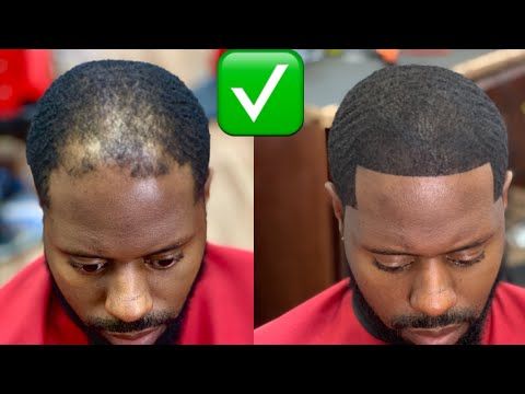 Huile de Batana 100% Pure – Redonne Vie à Vos Cheveux