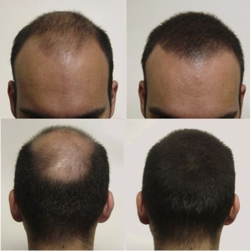 Huile de Batana 100% Pure – Redonne Vie à Vos Cheveux