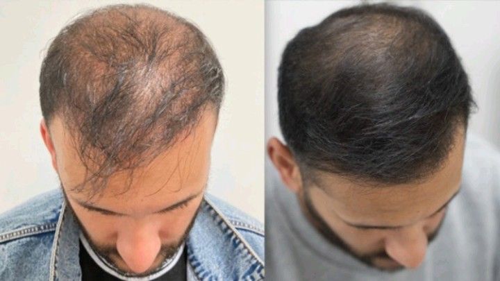 Huile de Batana 100% Pure – Redonne Vie à Vos Cheveux